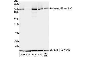 Western Blotting (WB) image for anti-Neurofibromin 1 (NF1) (C-Term) antibody (ABIN7795775) (Recombinant Neurofibromin 1 抗体  (C-Term))