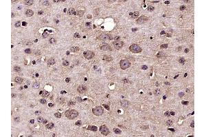 Paraformaldehyde-fixed, paraffin embedded mouse brain, Antigen retrieval by boiling in sodium citrate buffer (pH6) for 15min, Block endogenous peroxidase by 3% hydrogen peroxide for 30 minutes,  Blocking buffer (normal goat serum) at 37°C for 20min, Antibody incubation with Nucleoporin p62 Polyclonal Antibody(bs-2935R) at 1:400 overnight at 4°C, followed by a conjugated secondary and DAB staining. (NUP62 抗体  (AA 451-522))