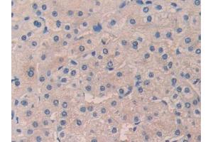Used in DAB staining on fromalin fixed paraffin-embedded Kidney tissue (desert Hedgehog 抗体  (AA 241-383))