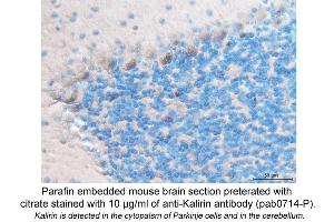 Image no. 1 for anti-Kalirin, RhoGEF Kinase (KALRN) (C-Term) antibody (ABIN559714) (KALRN 抗体  (C-Term))