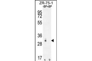 Western blot analysis of RAB40AL Antibdy (N-term) Pab (ABIN655950 and ABIN2845336) pre-incubated without(lane 1) and with(lane 2) blocking peptide in ZR-75-1 cell line lysate. (RAB40AL 抗体  (N-Term))