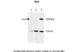 Lanes:  Lane 1: Jurkat lysate Lane 2: HeLa lysate Lane 3: GFP-Rinl transfected COS7 lysate Primary Antibody Dilution:  1:1000 Secondary Antibody:  Goat anti-rabbit-HRP Secondary Antibody Dilution:  1:5000 Gene Name:  RINL Submitted by:  Barbara Woller; Medical University of Vienna (RINL 抗体  (N-Term))