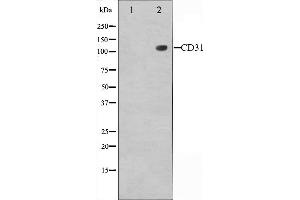 Western blot analysis of PECAM-1 expression in Jurkat whole cell lysates,The lane on the left is treated with the antigen-specific peptide. (CD31 抗体  (C-Term))