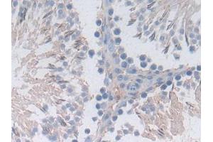 Immunohistochemistry (IHC) image for anti-Mitogen-Activated Protein Kinase 8 (MAPK8) (AA 138-370) antibody (ABIN7439327)