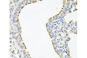 Immunohistochemistry of paraffin-embedded Mouse lung using SCNN1G Polyclonal Antibody at dilution of 1:100 (40x lens). (SCNN1G 抗体)