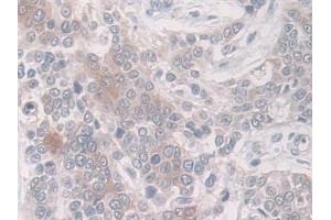 Immunohistochemistry (IHC) image for anti-Plasminogen Activator Inhibitor 1 (SERPINE1) antibody (ABIN7427915)