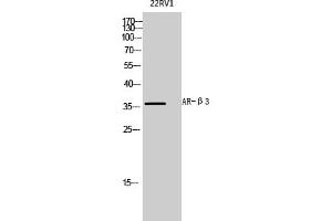 Western Blot analysis of 22RV1 cells using AR-β3 Polyclonal Antibody diluted at 1:1000. (ADRB3 抗体  (AA 220-300))