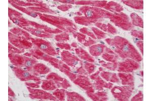 Human Heart: Formalin-Fixed, Paraffin-Embedded (FFPE). (NDUFB7 抗体  (FITC))