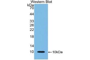 Western blot analysis of the recombinant protein. (beta-Thromboglobulin 抗体  (AA 46-107))