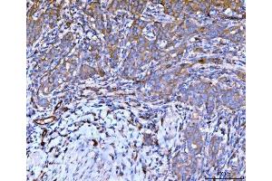 IHC analysis of Filamin B/FLNB using anti-Filamin B/FLNB antibody (ABIN7601606). (FLNB 抗体  (AA 397-701))