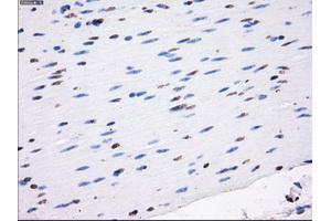 Immunohistochemical staining of paraffin-embedded colon tissue using anti-RC213323 mouse monoclonal antibody. (LOX 抗体  (AA 22-168))