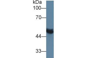 Western Blot; Sample: Rat Serum; Primary Ab: 1µg/ml Rabbit Anti-Rat MMP13 Antibody Second Ab: 0. (MMP13 抗体  (AA 62-217))