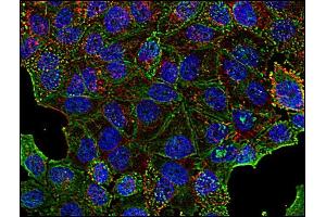 Immunofluorescence staining of clathrin in human HeLa cell line using anti-clathrin (Clathrin Heavy Chain (CLTC) 抗体)