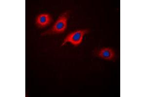 Immunofluorescent analysis of GLP-1 Receptor staining in SKNSH cells. (GLP1R 抗体  (Center))
