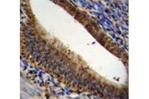 Immunohistochemistry analysis in human uterus tissue (Formalin-fixed, Paraffin-embedded) using Prothymosin alpha  Antibody (N-term), followed by peroxidase conjugated secondary antibody and DAB staining. (PTMA 抗体  (N-Term))