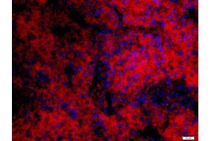 Paraformaldehyde-fixed, paraffin embedded mouse spleen, Antigen retrieval by boiling in sodium citrate buffer (pH6) for 15min, Block endogenous peroxidase by 3% hydrogen peroxide for 30 minutes, Blocking buffer (normal goat serum) at 37°C for 20min, Antibody incubation with 	IFN-Alpha Polyclonal Antibody, Unconjugated  at 1:200 overnight at 4°C, followed by a conjugated secondary Goat Anti-Rabbit IgG, Cy3 conjugated-Cy3)used at 1:200 dilution for 40 minutes at 37°C. (IFNA1 抗体  (AA 150-189))