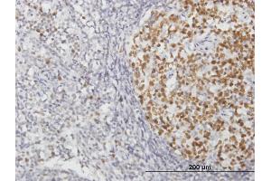 Immunostaining (ISt) image for anti-Replication Factor C (Activator 1) 2, 40kDa (RFC2) (AA 1-320) antibody (ABIN519742)