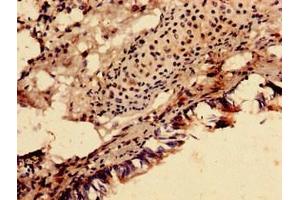 Immunocytochemistry (ICC) image for anti-Succinate Dehydrogenase Complex, Subunit A, Flavoprotein (Fp) (SDHA) (AA 44-293) antibody (ABIN7170882)