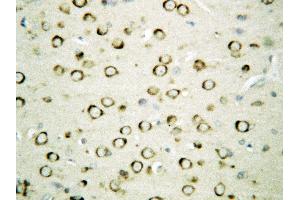Immunohistochemistry (IHC) image for anti-Heat Shock Protein 90kDa beta (Grp94), Member 1 (HSP90B1) (AA 687-700), (Middle Region) antibody (ABIN3044299)
