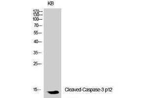 Western Blot analysis of KB cells using Cleaved-CASP3 p12 (D175) Polyclonal Antibody at dilution of 1:1000. (Caspase 3 p12 (Cleaved-Asp175) 抗体)