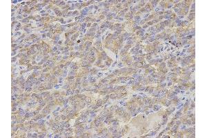 Immunohistochemistry (IHC) image for anti-S100 Calcium Binding Protein A12 (S100A12) antibody (ABIN1876516) (S100A12 抗体)