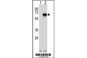 Western blot analysis of CETP using rabbit polyclonal CETP Antibody using 293 cell lysates (2 ug/lane) either nontransfected (Lane 1) or transiently transfected (Lane 2) with the CETP gene. (CETP 抗体  (N-Term))