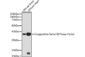 Western blot analysis of extracts of various cell lines, using Coagulation factor III/Tissue Factor antibody (ABIN3021933, ABIN3021934, ABIN3021935 and ABIN6217895) at 1:500 dilution. (Tissue factor 抗体)