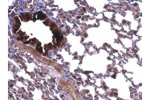 Immunohistochemistry (IHC) image for anti-ATP Synthase, H+ Transporting, Mitochondrial F1 Complex, alpha Subunit 1, Cardiac Muscle (ATP5A1) (C-Term) antibody (ABIN2855150)