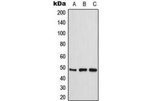 Western blot analysis of CKMT2 expression in THP1 (A), HeLa (B), Jurkat (C) whole cell lysates. (CKMT2 抗体  (Center))