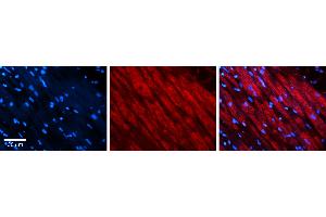 Rabbit Anti-DLST Antibody Catalog Number: ARP61476_P050 Formalin Fixed Paraffin Embedded Tissue: Human heart Tissue Observed Staining: Cytoplasmic Primary Antibody Concentration: 1:100 Other Working Concentrations: N/A Secondary Antibody: Donkey anti-Rabbit-Cy3 Secondary Antibody Concentration: 1:200 Magnification: 20X Exposure Time: 0. (DLST 抗体  (C-Term))