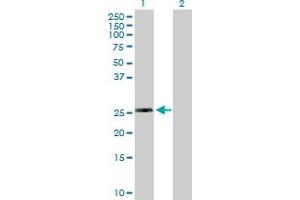 Western Blot analysis of RPL10L expression in transfected 293T cell line by RPL10L MaxPab polyclonal antibody. (RPL10L 抗体  (AA 1-214))