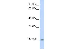 WB Suggested Anti-C2orf28 Antibody Titration: 0. (ATRAID 抗体  (C-Term))