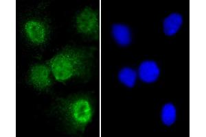 Immunofluorescent analysis of 4 % paraformaldehyde-fixed, 0. (T Antigen (AA 15-43), (N-Term) 抗体)