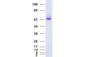 Validation with Western Blot