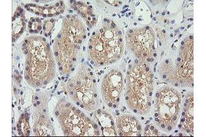 Image no. 1 for anti-Cancer/testis Antigen 1B (CTAG1B) antibody (ABIN1499892) (CTAG1B 抗体)