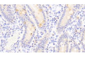 Immunohistochemistry (IHC) image for anti-Secretogranin III (SCG3) (AA 20-468) antibody (ABIN7436150)