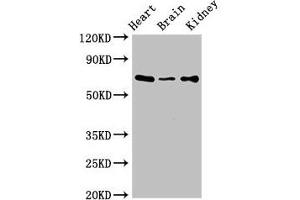 Western Blot Positive WB detected in: Mouse heart tissue, Mouse brain tissue, Mouse kidney tissue All lanes: SLC6A13 antibody at 3 μg/mL Secondary Goat polyclonal to rabbit IgG at 1/50000 dilution Predicted band size: 69, 58, 11 kDa Observed band size: 69 kDa (SLC6A13 抗体  (AA 1-40))