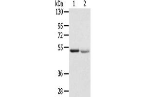 Gel: 8 % SDS-PAGE,Lysate: 40 μg,Lane 1-2: Human placenta tissue, Human normal kidney tissue,Primary antibody: ABIN7192531(SLC8B1 Antibody) at dilution 1/200 dilution,Secondary antibody: Goat anti rabbit IgG at 1/8000 dilution,Exposure time: 1 minute (SLC24A6 抗体)