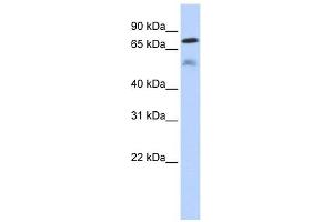 DUSP8 antibody used at 1 ug/ml to detect target protein. (DUSP8 抗体  (Middle Region))