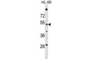 T161A Antibody (N-term) (ABIN1881865 and ABIN2839083) western blot analysis in HL-60 cell line lysates (35 μg/lane). (TMEM161A 抗体  (N-Term))