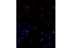 Immunofluorescence analysis of PC-12 cells using Filamin A antibody (ABIN7267206) at dilution of 1:100 (40x lens). (Filamin A 抗体  (C-Term))
