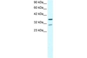 Western Blotting (WB) image for anti-Zinc Finger Protein 385A (ZNF385A) antibody (ABIN2460497) (ZNF385A 抗体)