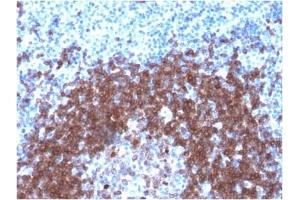ABIN6383859 to CD79a was successfully used to stain human tonsil sections. (Recombinant CD79a 抗体  (AA 202-216))