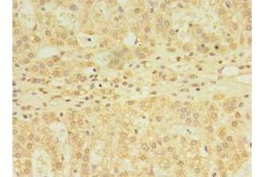 Immunohistochemistry of paraffin-embedded human adrenal gland tissue using ABIN7171119 at dilution of 1:100 (YKT6 抗体  (AA 10-195))