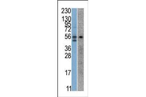 The anti-STK38 Pab is used in Western blot to detect STK38 in SK-Br-3 (left) and Jurkat (right) cell line lysates. (STK38 抗体  (C-Term))