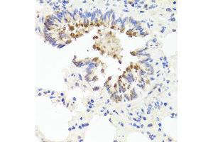 Immunohistochemistry of paraffin-embedded rat lung using FLI20294 antibody at dilution of 1:100 (x40 lens). (AMBRA1 抗体)