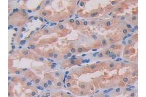 Detection of ITGb1 in Human Kidney Tissue using Polyclonal Antibody to Integrin Beta 1 (ITGb1) (ITGB1 抗体  (AA 140-383))