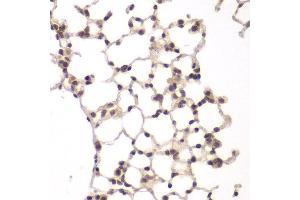 Immunohistochemistry of paraffin-embedded rat lung using VRK1 antibody at dilution of 1:100 (40x lens). (VRK1 抗体)