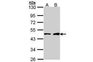 Image no. 1 for anti-GATA Binding Protein 1 (Globin Transcription Factor 1) (GATA1) (AA 28-236) antibody (ABIN467586) (GATA1 抗体  (AA 28-236))