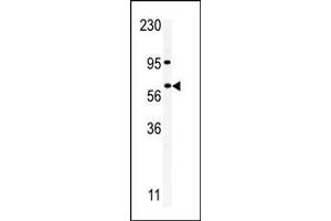 Western blot analysis of anti-RIOK1 Pab in  cell line lysate. (RIOK1 抗体  (C-Term))